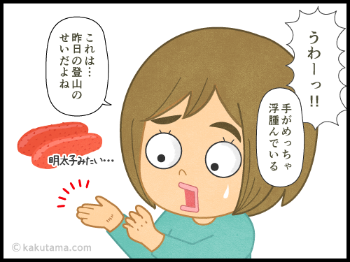 下山後にむくみでパンパンになっている登山者のイラスト