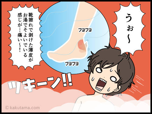 登山後の靴擦れ状態でお風呂に入ると痛い漫画